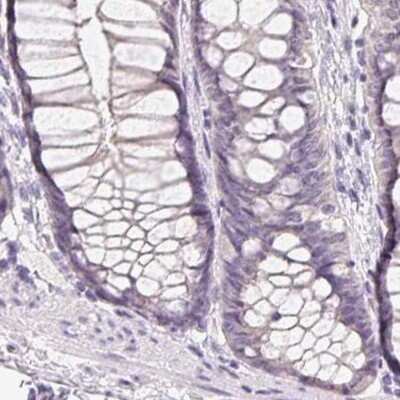 Immunohistochemistry-Paraffin: SP-D Antibody [NBP2-33424]