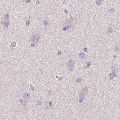 Immunohistochemistry-Paraffin: SP-D Antibody [NBP2-33424]