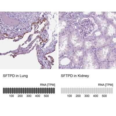 Immunohistochemistry-Paraffin: SP-D Antibody [NBP2-38803]