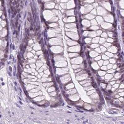 Immunohistochemistry-Paraffin: SP-D Antibody [NBP2-38803]
