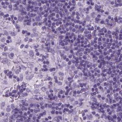 Immunohistochemistry-Paraffin: SP-D Antibody [NBP2-38803]