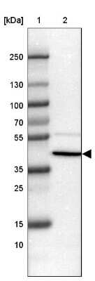 Western Blot: SP-D Antibody [NBP2-33424]