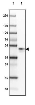 Western Blot: SP-D Antibody [NBP2-38803]
