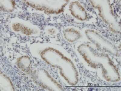 Immunohistochemistry-Paraffin: SP1 Antibody (1A5) [H00006667-M02]
