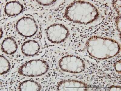 Immunohistochemistry-Paraffin: SP1 Antibody (1A5) [H00006667-M02]