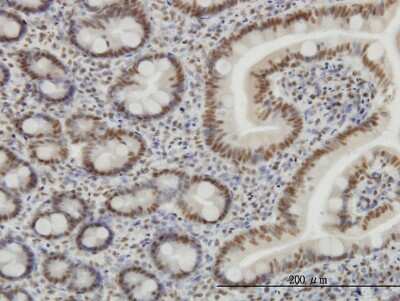 Immunohistochemistry-Paraffin: SP1 Antibody (4C8) [H00006667-M03]