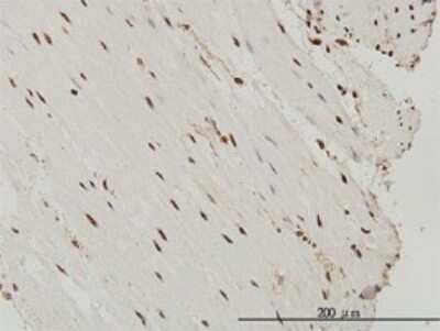 Immunohistochemistry-Paraffin: SP1 Antibody (4C8) [H00006667-M03]