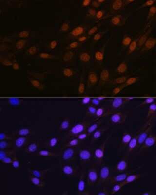 Immunocytochemistry/ Immunofluorescence: SP1 Antibody (5I3A8) [NBP3-15837]