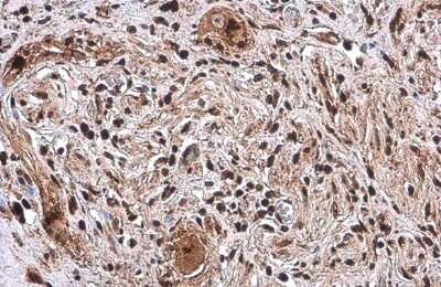 Immunohistochemistry-Paraffin: SP1 Antibody (GT2574) [NBP3-13611]