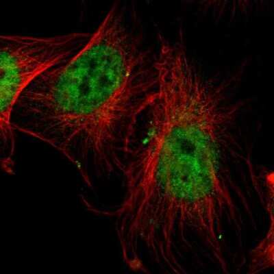 Immunocytochemistry/ Immunofluorescence: SP1 Antibody [NBP1-85812]