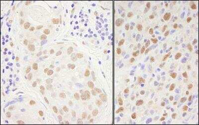 Immunohistochemistry-Paraffin: SP1 Antibody [NB600-232]