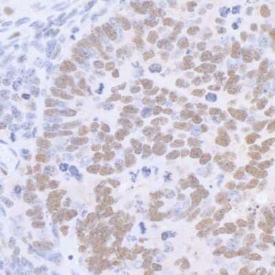 Immunohistochemistry-Paraffin: SP1 Antibody [NB600-233]
