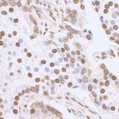 Immunohistochemistry-Paraffin: SP1 Antibody [NB600-233]