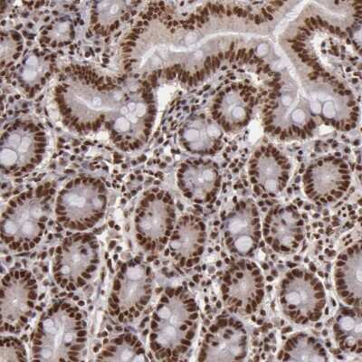 Immunohistochemistry-Paraffin: SP1 Antibody [NBP1-85812]