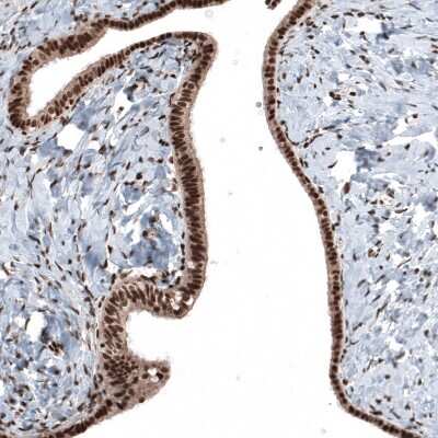 Immunohistochemistry-Paraffin: SP1 Antibody [NBP1-89458]