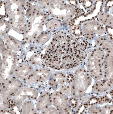 Immunohistochemistry-Paraffin: SP1 Antibody [NBP1-89458]