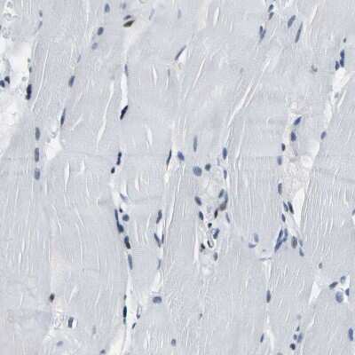 Immunohistochemistry-Paraffin: SP1 Antibody [NBP1-89458]