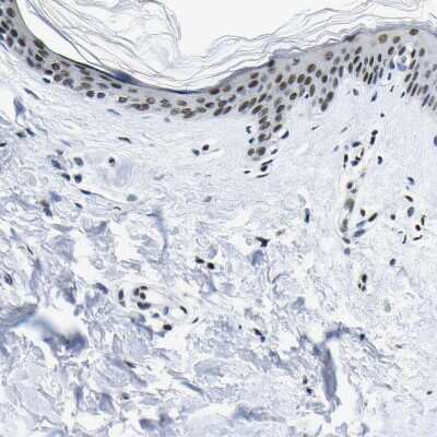 Immunohistochemistry-Paraffin: SP1 Antibody [NBP1-89458]
