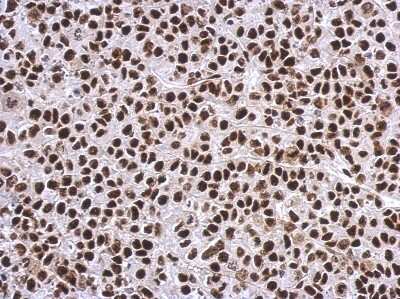 Immunohistochemistry-Paraffin: SP1 Antibody [NBP2-20460]