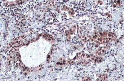 Immunohistochemistry-Paraffin: SP1 Antibody [NBP2-20460]