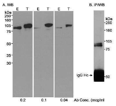 Immunoprecipitation: SP1 Antibody [NB600-233]