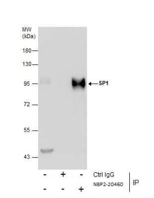 Immunoprecipitation: SP1 Antibody [NBP2-20460]