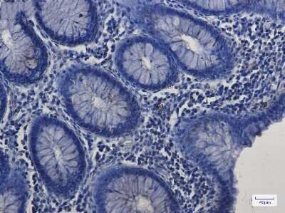 Immunohistochemistry-Paraffin: SP1 Antibody (S01-9G6) [NBP3-14976]