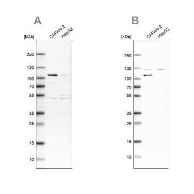 Western Blot: SP1 Antibody [NBP1-85812]