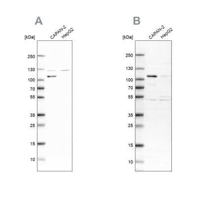 Western Blot: SP1 Antibody [NBP1-89458]