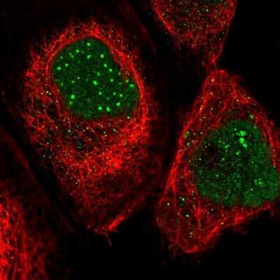 Immunocytochemistry/ Immunofluorescence: SP100 Antibody [NBP1-89457]