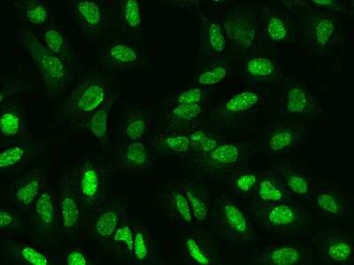 Immunocytochemistry/ Immunofluorescence: SP100 Antibody [NBP2-97407]