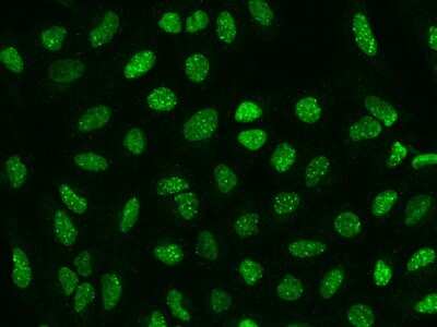 Immunocytochemistry/ Immunofluorescence: SP100 Antibody [NBP2-97408]