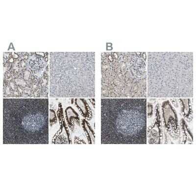 Immunohistochemistry-Paraffin: SP100 Antibody [NBP1-86060]