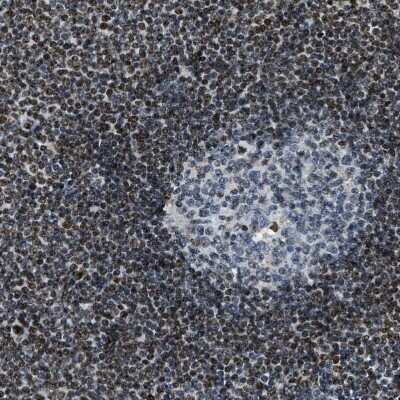 Immunohistochemistry-Paraffin: SP100 Antibody [NBP1-86060]