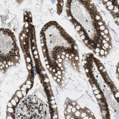 Immunohistochemistry-Paraffin: SP100 Antibody [NBP1-86060]