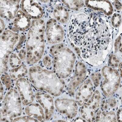 Immunohistochemistry-Paraffin: SP100 Antibody [NBP1-86060]