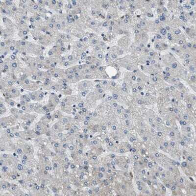 Immunohistochemistry-Paraffin: SP100 Antibody [NBP1-86060]