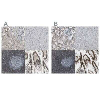 Immunohistochemistry-Paraffin: SP100 Antibody [NBP1-89457]