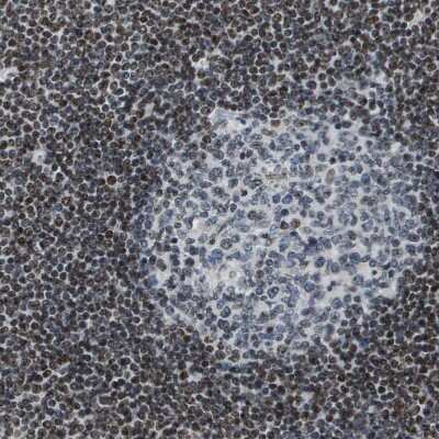 Immunohistochemistry-Paraffin: SP100 Antibody [NBP1-89457]