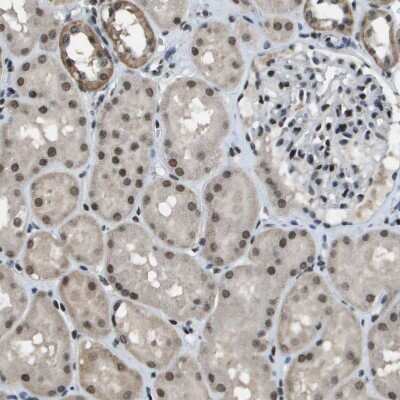 Immunohistochemistry-Paraffin: SP100 Antibody [NBP1-89457]