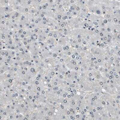 Immunohistochemistry-Paraffin: SP100 Antibody [NBP1-89457]