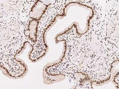 Immunohistochemistry-Paraffin: SP100 Antibody [NBP2-97407]