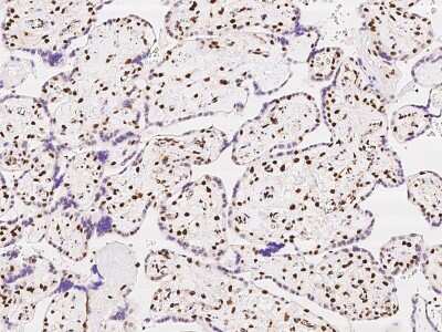 Immunohistochemistry-Paraffin: SP100 Antibody [NBP2-97408]