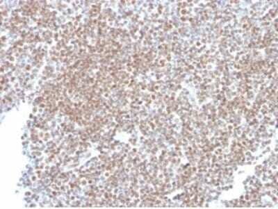 Immunohistochemistry-Paraffin: SP100 Antibody (PCRP-SP100-1B9) [NBP3-13780]