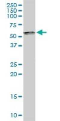 Western Blot: SP100 Antibody [H00006672-D01P]