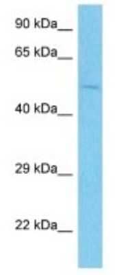 Western Blot: SP100 Antibody [NBP3-10281]