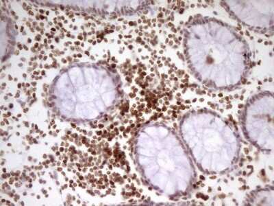 Immunohistochemistry: SP110 Antibody (OTI4C1) [NBP2-45919]