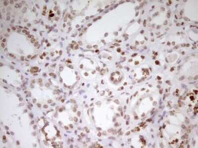 Immunohistochemistry: SP110 Antibody (OTI4C1) [NBP2-45919]
