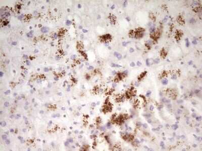 Immunohistochemistry: SP110 Antibody (OTI4C1) [NBP2-45919]