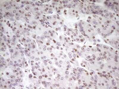Immunohistochemistry: SP110 Antibody (OTI4C1) [NBP2-45919]